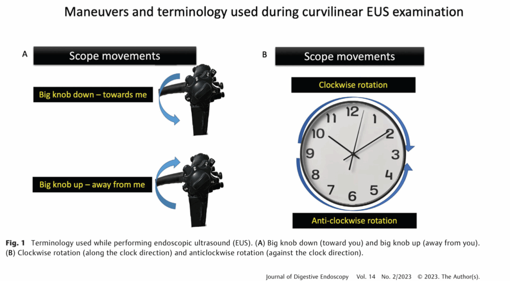 Diagram of manoeuvres and terminology used during curvilinear EUS