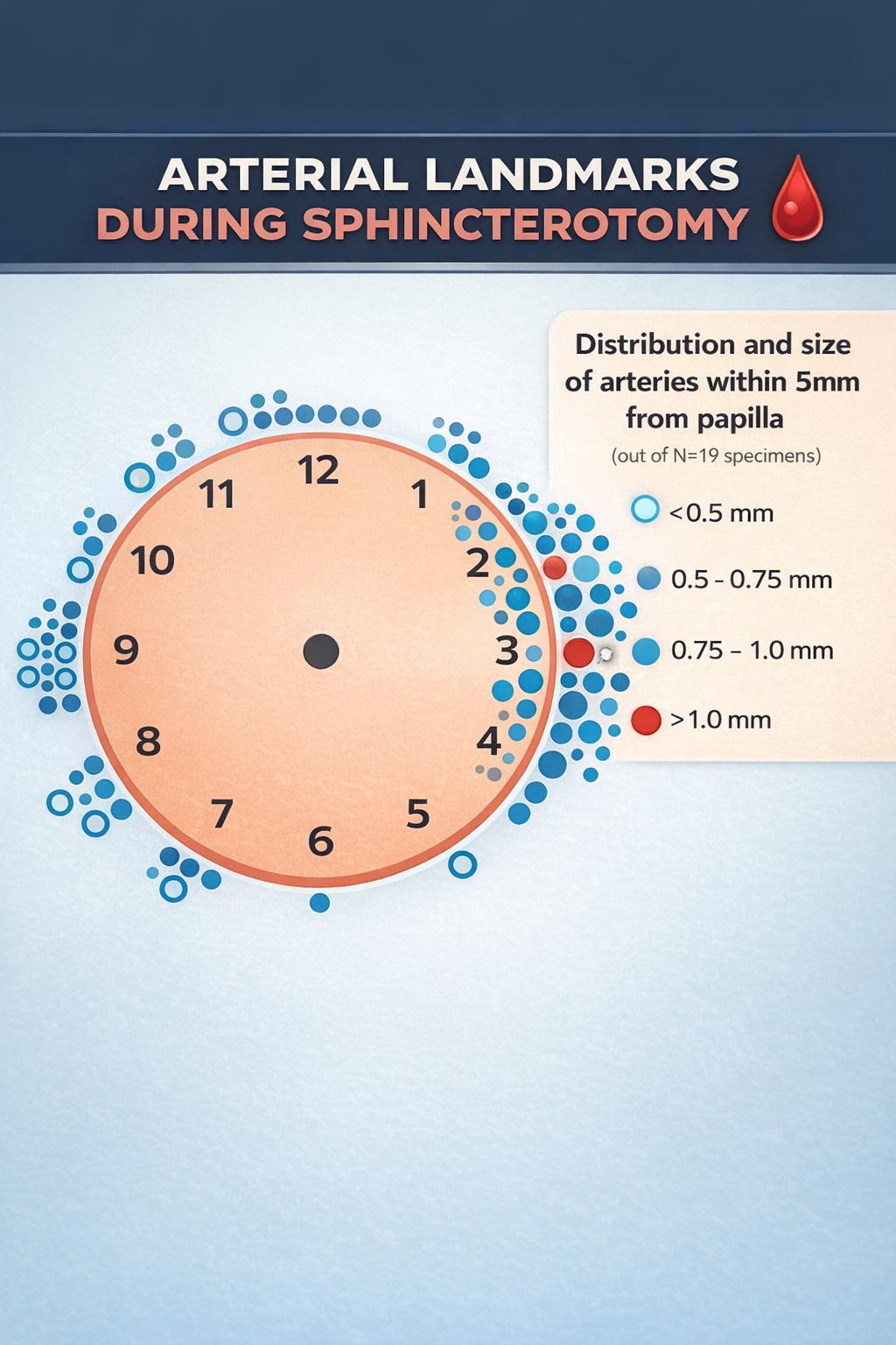 Clock-face diagram of arterial landmarks during sphincterotomy