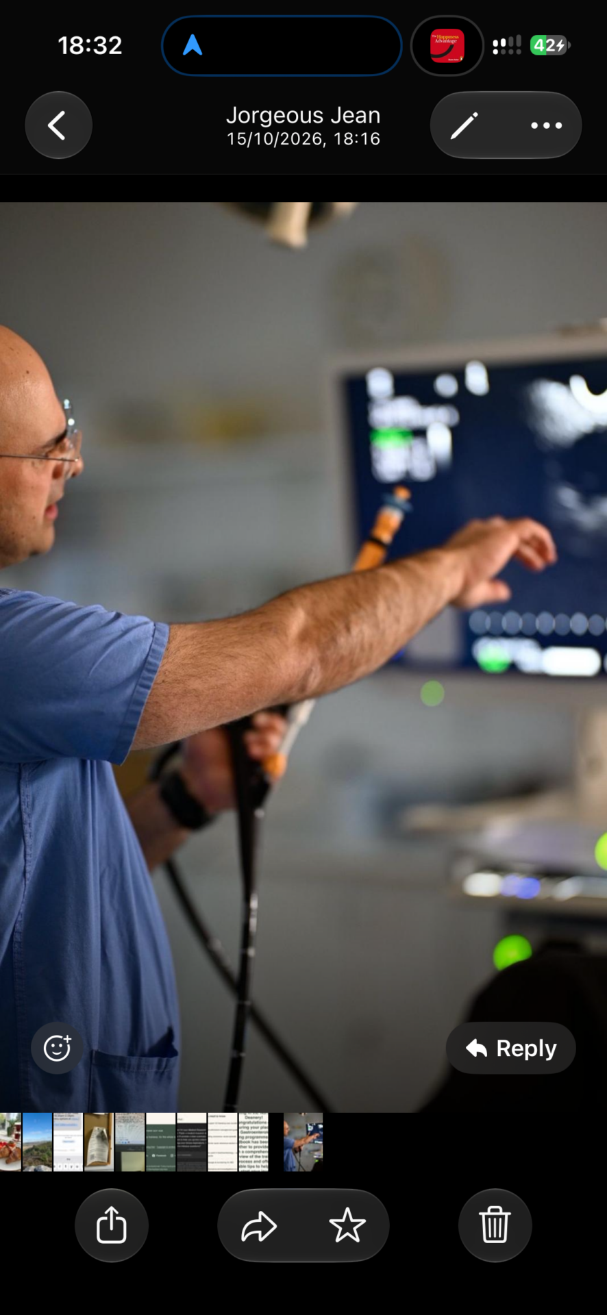 Clinician performing linear EUS guided biopsy while viewing the ultrasound monitor.